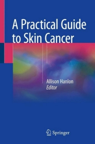Practical Guide to Skin Cancer
