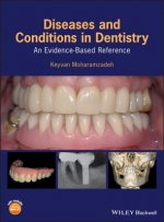 Diseases and Conditions in Dentistry - An Evidence-Based Reference