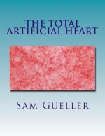 The Total Artificial Heart: Past and Future