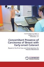 Concomitant Presence of Carcinoma of Breast with Early-onset Cataract