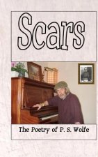Scars