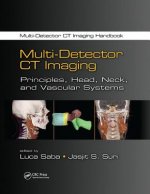 Multi-Detector CT Imaging