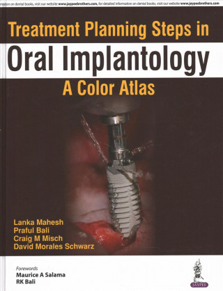 Treatment Planning Steps in Oral Implantology