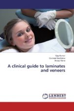 A clinical guide to laminates and veneers