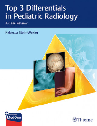Top 3 Differentials in Pediatric Radiology (Rebecca Stein-Wexler)(Puha kötésű)