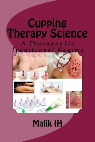 Cupping Therapy Science: A Therapeutic Traditional Regime