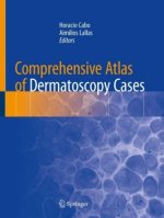 Comprehensive Atlas of Dermatoscopy Cases