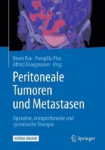 Peritoneale Tumoren und Metastasen