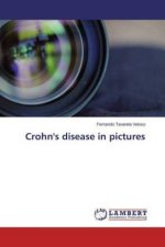 Crohn's disease in pictures