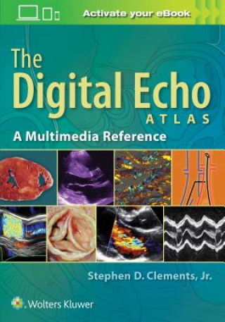 Digital Echo Atlas