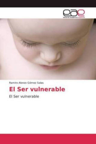 Ser vulnerable