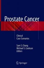 Prostate Cancer