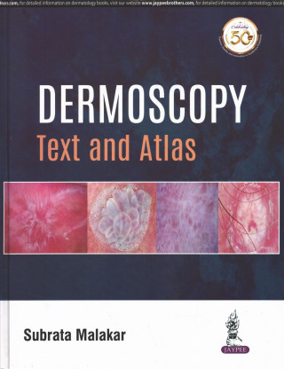 Dermoscopy