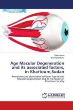 Age Macular Degeneration and its associated factors, in Khartoum,Sudan