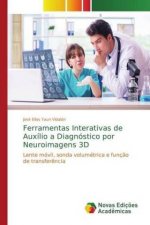 Ferramentas Interativas de Auxilio a Diagnostico por Neuroimagens 3D