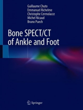 Bone SPECT/CT of Ankle and Foot