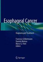 Esophageal Cancer