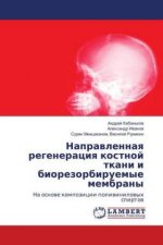 Naprawlennaq regeneraciq kostnoj tkani i biorezorbiruemye membrany