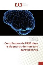Contribution de l'IRM dans le diagnostic des tumeurs parotidiennes