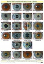 Konstitutionsorientierte Irisdiagnose, Wandtafel