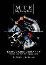 Echocardiography - MyEasyTest