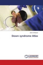 Down syndrome Atlas