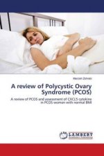review of Polycystic Ovary Syndrome (PCOS)