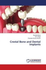 Crestal Bone and Dental Implants