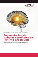 Segmentacion de tumores cerebrales en IRM, via Graph Cuts