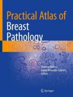 Practical Atlas of Breast Pathology