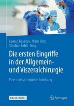 Die ersten Eingriffe in der Allgemein- und Viszeralchirurgie , m. 1 Buch, m. 1 E-Book