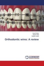 Orthodontic wires: A review