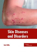Skin Diseases and Disorders