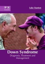 Down Syndrome: Diagnosis, Treatment and Management