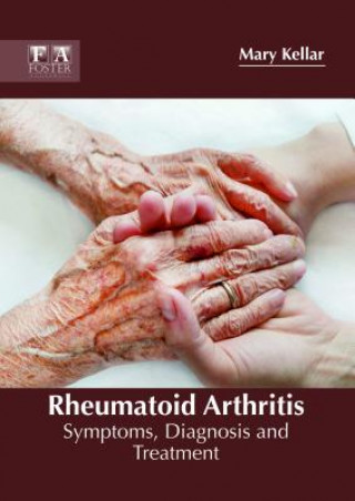 Rheumatoid Arthritis: Symptoms, Diagnosis and Treatment