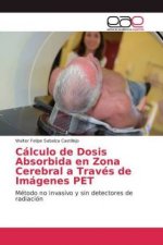 Calculo de Dosis Absorbida en Zona Cerebral a Traves de Imagenes PET