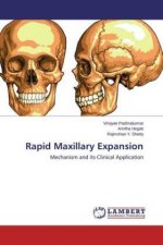 Rapid Maxillary Expansion