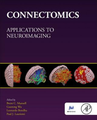 Connectomics