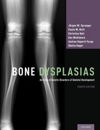 Bone Dysplasias