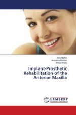 Implant-Prosthetic Rehabilitation of the Anterior Maxilla