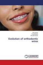 Evolution of orthodontic wires