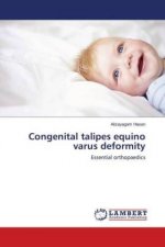 Congenital talipes equino varus deformity