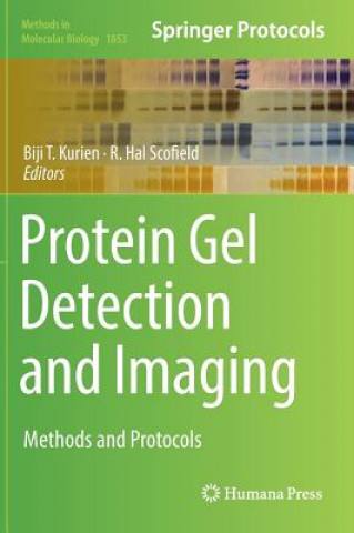 Protein Gel Detection and Imaging