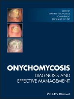 Onychomycosis - Diagnosis and Effective Management