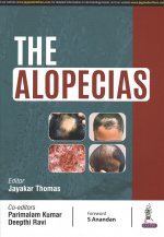 Alopecias