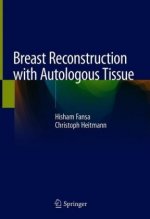 Breast Reconstruction with Autologous Tissue