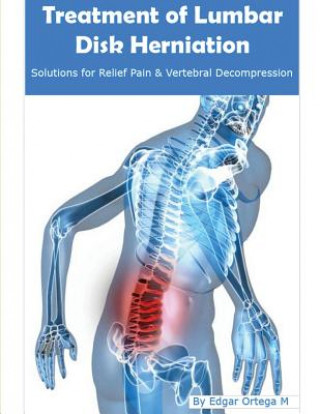 Treatment of Lumbar Disk Herniation: Back Pain Relief and Herniated Discs Solutions