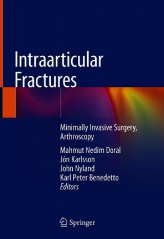 Intraarticular Fractures