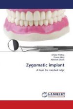 Zygomatic implant