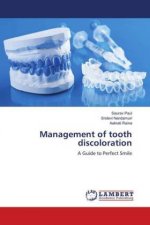Management of tooth discoloration